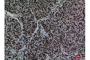 Immunohistochemistry (IHC) analysis of paraffin-embedded Human Pancreas, antibody was diluted at 1:100. (CD2 antibody  (N-Term))