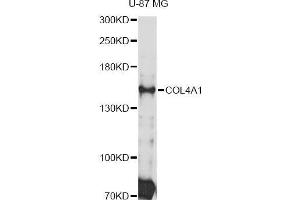 Western blot analysis of extracts of U-87 MG cells, using COL4A1 Antibody (ABIN5997482) at 1:3000 dilution.