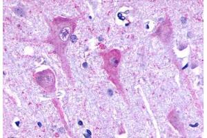 Anti-P2RY8 / P2Y8 antibody  ABIN1049223 IHC staining of human brain, neurons and glia.