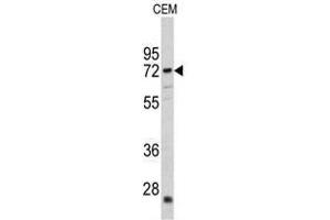 Image no. 1 for anti-Carnitine O-Acetyltransferase (CRAT) (N-Term) antibody (ABIN452873) (CRAT antibody  (N-Term))