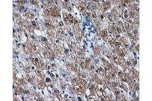 Immunohistochemical staining of paraffin-embedded liver tissue using anti-LEMD3mouse monoclonal antibody. (LEMD3 antibody)