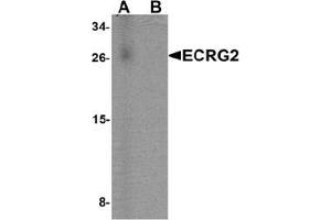 Western blot analysis of ECRG2 in human lung tissue lysate with ECRG2 Antibody  at 1 ug/mL in (A) the absence and (B) the presence of blocking peptide. (SPINK7/ECRG2 antibody  (C-Term))