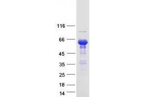 Validation with Western Blot (SNTB1 Protein (Myc-DYKDDDDK Tag))