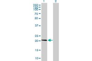 Western Blot analysis of AP3S1 expression in transfected 293T cell line by AP3S1 MaxPab polyclonal antibody.
