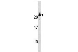 GSTT2 antibody western blot analysis in A549 lysate. (GSTT2 antibody  (AA 113-141))