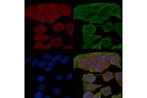 ABIN6258774 and ABIN6274538 staining Hela cells(30 min of UV treatment) by IF/ICC. (EPH Receptor A6 antibody  (C-Term))