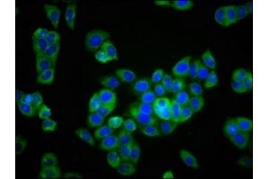 Immunofluorescence staining of PC-3 cells with ABIN7163936 at 1:166, counter-stained with DAPI. (KCNK9 antibody  (AA 250-362))
