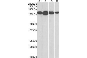 Radixin antibody  (Internal Region)