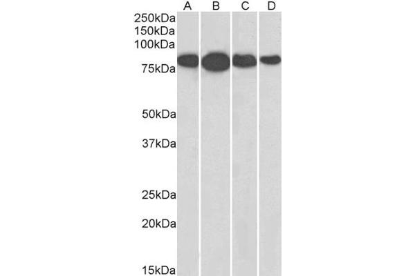 Radixin antibody  (Internal Region)