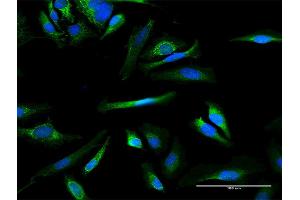 Immunofluorescence of purified MaxPab antibody to MMAB on HeLa cell.