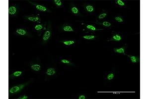 Immunofluorescence of monoclonal antibody to PAX9 on HeLa cell. (PAX9 antibody  (AA 205-300))