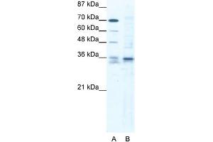 WB Suggested Anti-SOX12 Antibody Titration: 1. (SOX12 antibody  (C-Term))