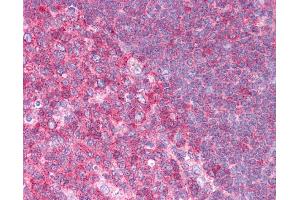 HSPA8 antibody was used for immunohistochemistry at a concentration of 4-8 ug/ml. (Hsc70 antibody  (N-Term))