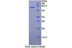 SDS-PAGE (SDS) image for CD34 (CD34) (AA 36-287) protein (His tag,GST tag) (ABIN2122642) (CD34 Protein (CD34) (AA 36-287) (His tag,GST tag))