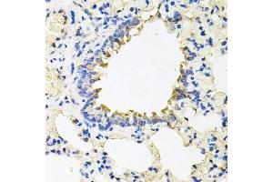 Immunohistochemistry of paraffin-embedded rat lung using CALU antibody (ABIN5973922) at dilution of 1/100 (40x lens).