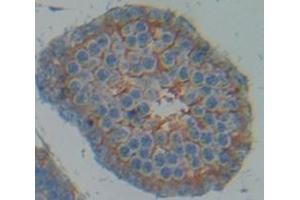 Figure. (ADAM17 antibody  (AA 221-451))