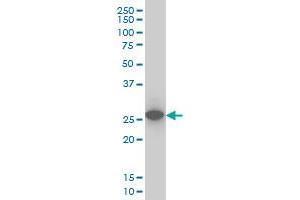 UCHL1 monoclonal antibody (M01), clone 1B8-4D2 Western Blot analysis of UCHL1 expression in IMR-32 . (UCHL1 antibody  (AA 1-223))