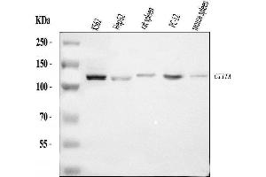 Western blot analysis of CIITA using anti-CIITA antibody (ABIN7601374).