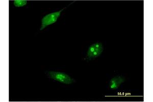 Immunofluorescence of monoclonal antibody to RPL10L on HeLa cell.