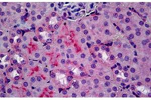 Mouse Kidney: Formalin-Fixed, Paraffin-Embedded (FFPE) (C5AR1 antibody)