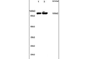 Lane 1: rat kidney lysates Lane 2: rat brain lysates probed with Anti alpha Actinin 4 Polyclonal Antibody, Unconjugated (ABIN733778) at 1:200 in 4 °C. (alpha Actinin 4 antibody)