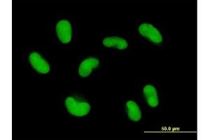 Immunofluorescence of purified MaxPab antibody to ZNF468 on HepG2 cell. (ZNF468 antibody  (AA 1-469))