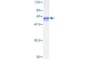 Image no. 2 for Testis-Specific Serine Kinase 3 (TSSK3) (AA 1-268) protein (GST tag) (ABIN1323981) (TSSK3 Protein (AA 1-268) (GST tag))