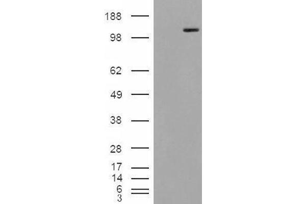 alpha-Mannosidase II antibody  (Internal Region)