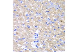 Immunohistochemistry of paraffin-embedded mouse heart using GPAM antibody (ABIN5973973) at dilution of 1/100 (40x lens). (GPAM antibody)