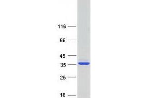 Validation with Western Blot