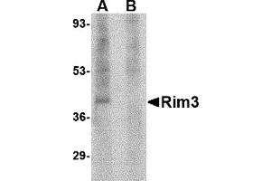 Western Blotting (WB) image for anti-Regulating Synaptic Membrane Exocytosis 3 (RIMS3) (N-Term) antibody (ABIN1031542) (RIMS3 antibody  (N-Term))