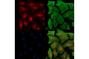 Phospho-Parkin (Ser65) Antibody staining A549 cells(H2O2 treatment) by IF/ICC.