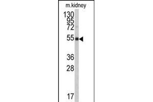 Western blot analysis of anti-ALDH9A1 Antibody (N-term) (ABIN6242161 and ABIN6579017) in mouse kidney tissue lysates (35 μg/lane). (ALDH9A1 antibody  (N-Term))