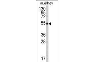 Western blot analysis of anti-ALDH9A1 Antibody (N-term) (ABIN6242161 and ABIN6579017) in mouse kidney tissue lysates (35 μg/lane). (ALDH9A1 antibody  (N-Term))