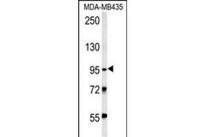 TRHDE Antibody (C-term) (ABIN651822 and ABIN2840414) western blot analysis in MDA-M cell line lysates (15 μg/lane). (TRHDE antibody  (C-Term))