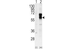 Western Blotting (WB) image for anti-Activin A Receptor Type II-Like 1 (ACVRL1) antibody (ABIN3003504) (ACVRL1 antibody)