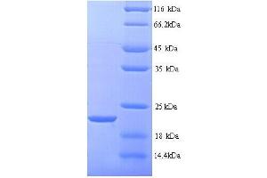 Matrix Metallopeptidase 7 (Matrilysin, Uterine) (MMP7) (AA 98-267), (full length) protein (His tag) (MMP7 Protein (AA 98-267, full length) (His tag))