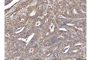 IHC analysis of ACADM/MCAD using anti-ACADM/MCAD antibody (ABIN7601543). (Medium-Chain Specific Acyl-CoA Dehydrogenase, Mitochondrial (MCAD) (AA 38-401) antibody)