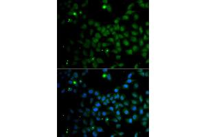 Immunofluorescence analysis of A549 cells using SMAD9 antibody (ABIN5975592). (SMAD9 antibody)