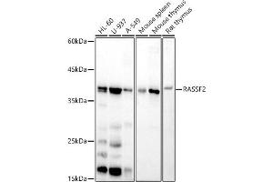 Western blot analysis of extracts of various cell lines, using R antibody (ABIN7269858) at 1:500 dilution. (RASSF2 antibody)