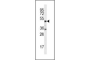 DSN1 Antibody (C-term) (ABIN656747 and ABIN2845971) western blot analysis in MDA-M cell line lysates (35 μg/lane). (DSN1 antibody  (C-Term))