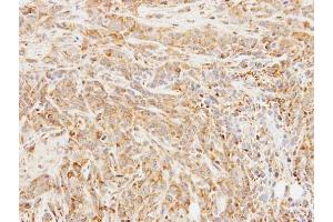 IHC-P Image Immunohistochemical analysis of paraffin-embedded SAS xenograft, using BCHE, antibody at 1:100 dilution. (Butyrylcholinesterase antibody)