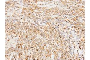 IHC-P Image Immunohistochemical analysis of paraffin-embedded SAS xenograft, using BCHE, antibody at 1:100 dilution. (Butyrylcholinesterase antibody)