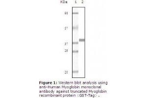 Image no. 2 for anti-Myoglobin (MB) antibody (ABIN207623) (Myoglobin antibody)