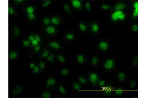 Immunofluorescence of monoclonal antibody to PCNA on HeLa cell. (PCNA antibody  (AA 1-261))
