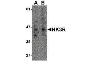 Western Blotting (WB) image for anti-Tachykinin Receptor 3 (TACR3) antibody (ABIN2476672) (TACR3 antibody)