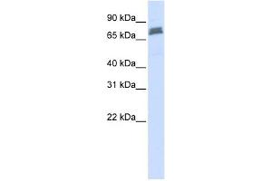 TRIM45 antibody used at 1 ug/ml to detect target protein. (TRIM45 antibody  (N-Term))