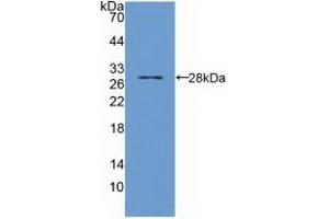 Detection of Recombinant TIRAP, Human using Polyclonal Antibody to Toll Interleukin 1 Receptor Domain Containing Adaptor Protein (TIRAP) (TIRAP antibody  (AA 1-221))