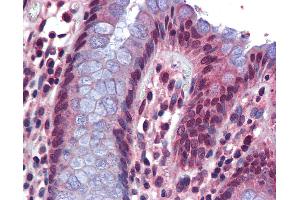 Anti-SRSF4 / SFRS4 antibody IHC of human colon. (SRSF4 antibody  (AA 359-408))