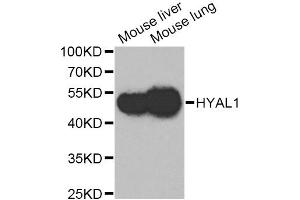 Western blot analysis of extracts of various cell lines, using HYAL1 Antibody. (HYAL1 antibody)
